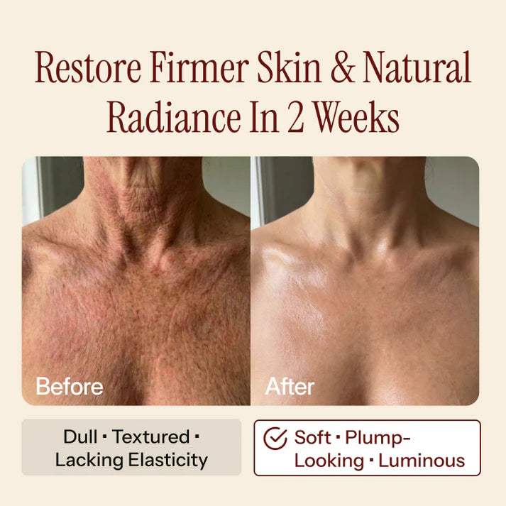 Stemhalo Glow Body Oil | Firm, Tighten & Brighten Sagging Body Skin