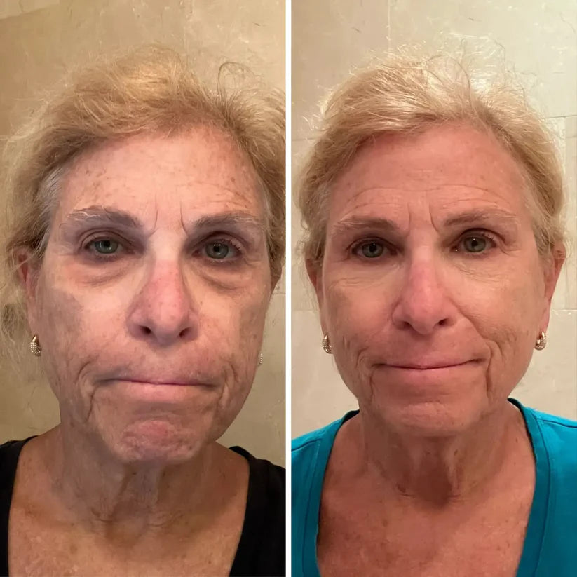 Stemhalo All-In-One Under-Eye Renewal Balm Brightens, Depuffs & Smooths Lines