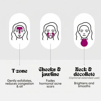 Stemhalo Alpha Arbutin+TXA Brightening Cream | Rapidly Fade Freckles, Acne Scars & Melasma, Reveal Luminous Glass Skin