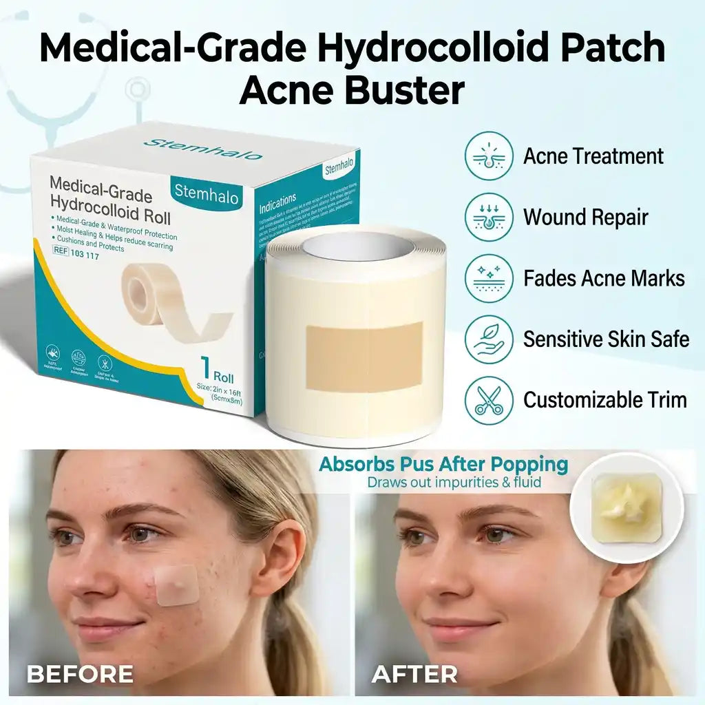 Stemhalo Hydrocolloid Acne Patch | Treat Pimples, Repair Wounds & Fade Acne Marks