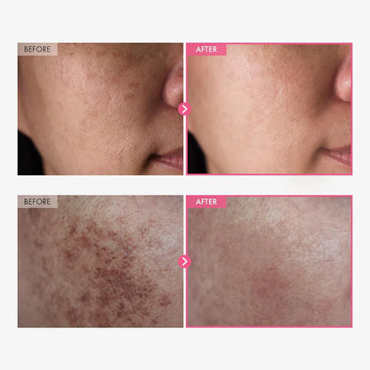Stemhalo Arbutin Cream | Erase Dark Spots, Even Tone, Gentle Formula For Sensitive Skin