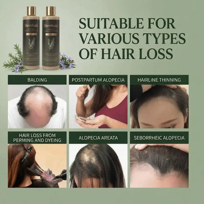 Stemhalo Growth-Support Shampoo | Stop Excessive Shedding & Grow Denser Hair