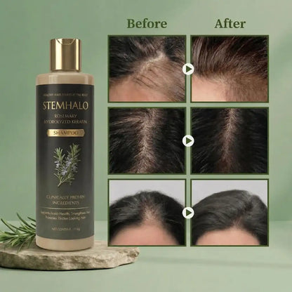Stemhalo Growth-Support Shampoo | Stop Excessive Shedding & Grow Denser Hair