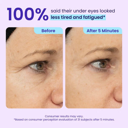 Stemhalo Instant Lift Eye Gel | For Puffiness & Bags, Wrinkles, Fine Lines and Dark Circles