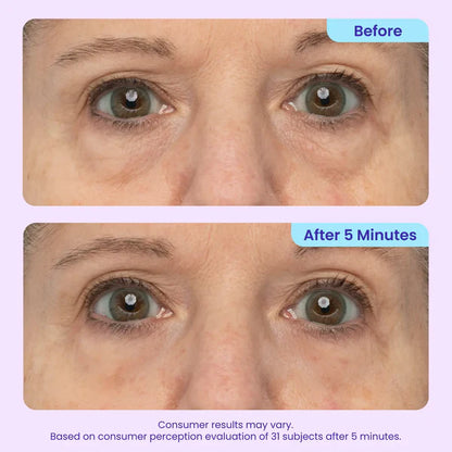 Stemhalo Instant Lift Eye Gel | For Puffiness & Bags, Wrinkles, Fine Lines and Dark Circles