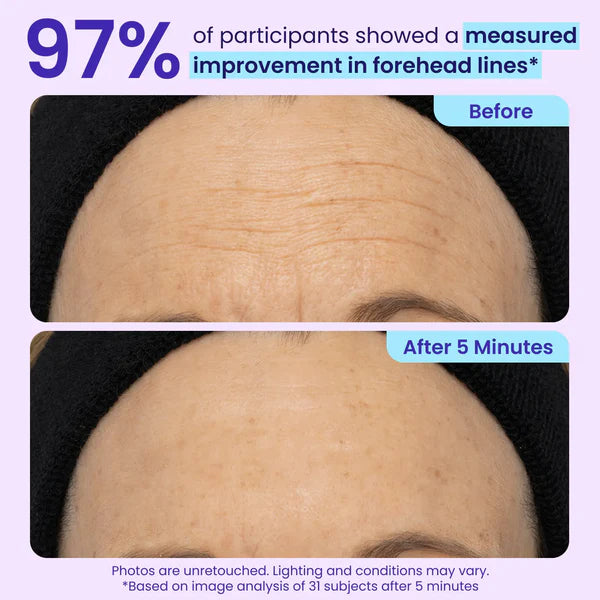 Stemhalo Instant Lift Eye Gel | For Puffiness & Bags, Wrinkles, Fine Lines and Dark Circles