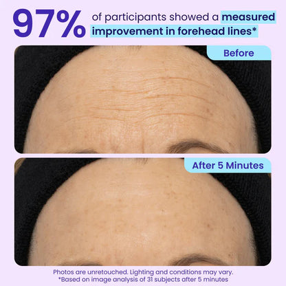 Stemhalo Instant Lift Eye Gel | For Puffiness & Bags, Wrinkles, Fine Lines and Dark Circles