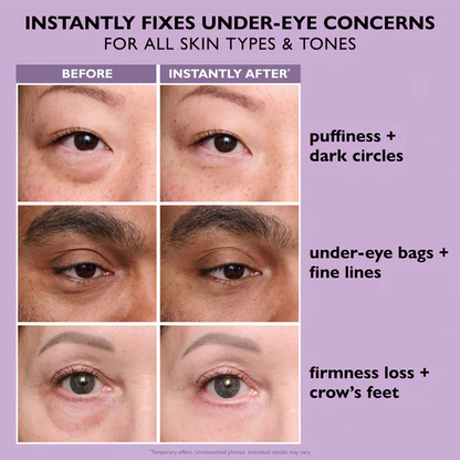 Stemhalo Instant Lift Eye Gel | For Puffiness & Bags, Wrinkles, Fine Lines and Dark Circles