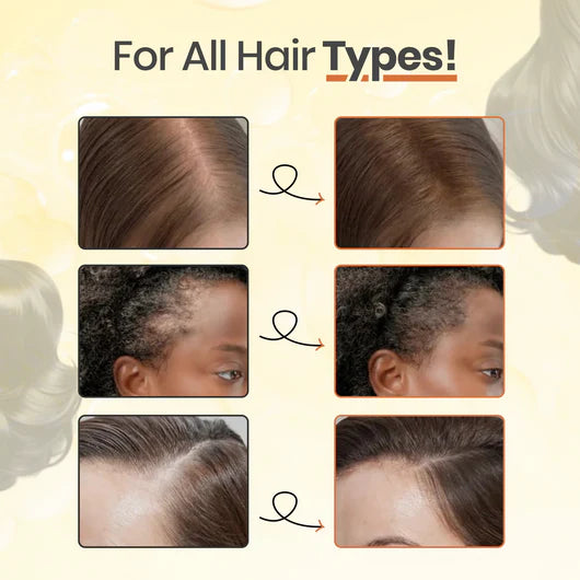 Stemhalo Hair Revive | Grow New Hair, Nourish Scalp & Reduce Hair Thinning