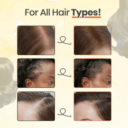 Stemhalo Hair Revive | Grow New Hair, Nourish Scalp & Reduce Hair Thinning