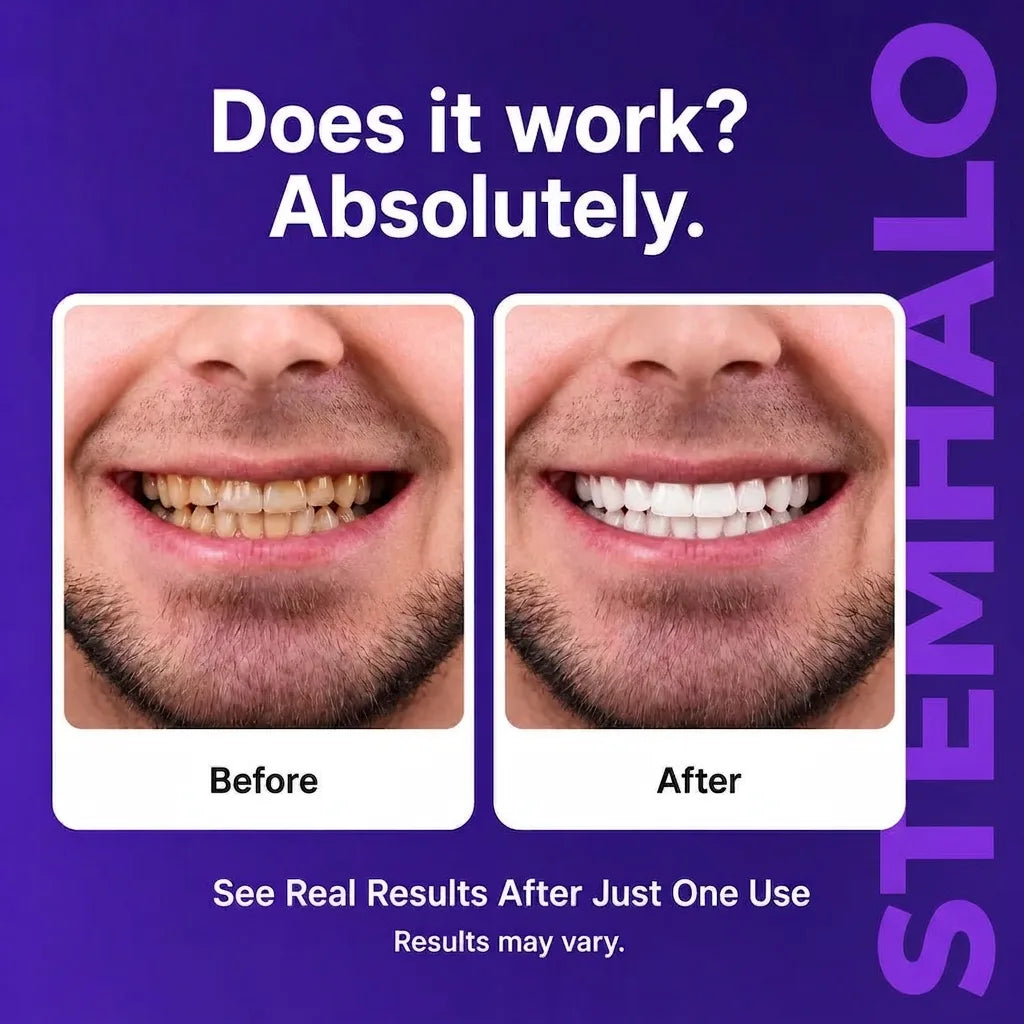 Stemhalo™🔥V34 Purple Whitening Strips, Instant Yellow Teeth Brightening