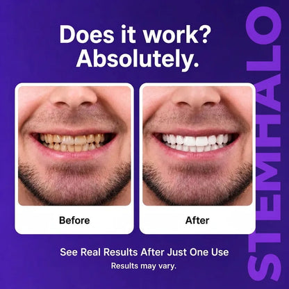 Stemhalo™🔥V34 Purple Whitening Strips, Instant Yellow Teeth Brightening