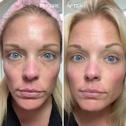 Stemhalo All-In-One Under-Eye Renewal Balm Brightens, Depuffs & Smooths Lines