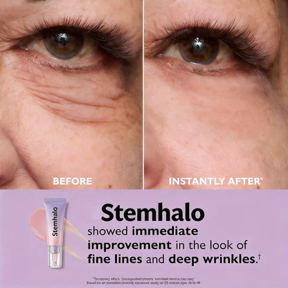 Stemhalo Instant Lift Eye Gel | For Puffiness & Bags, Wrinkles, Fine Lines and Dark Circles