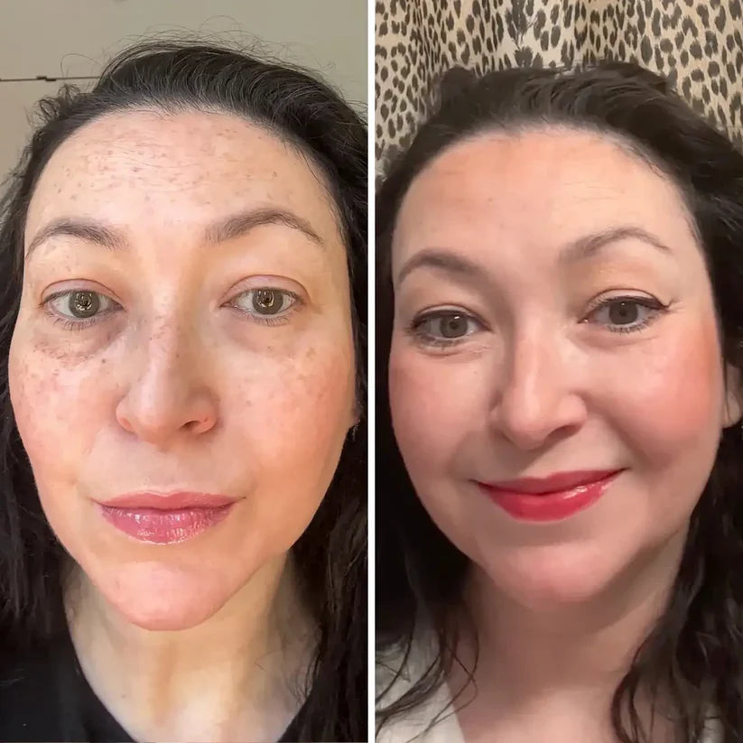 Stemhalo All-In-One Under-Eye Renewal Balm Brightens, Depuffs & Smooths Lines