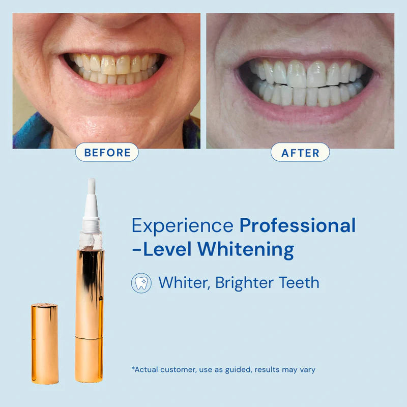 Stemhalo Teeth Whitening Serum Pen Whiten Teeth & Remove Stains