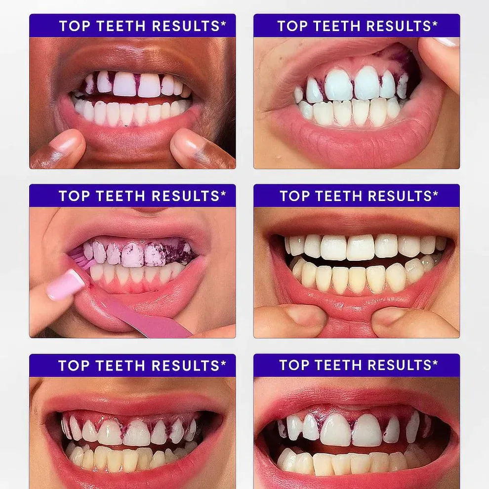 Stemhalo™🔥V34 Purple Whitening Strips, Instant Yellow Teeth Brightening