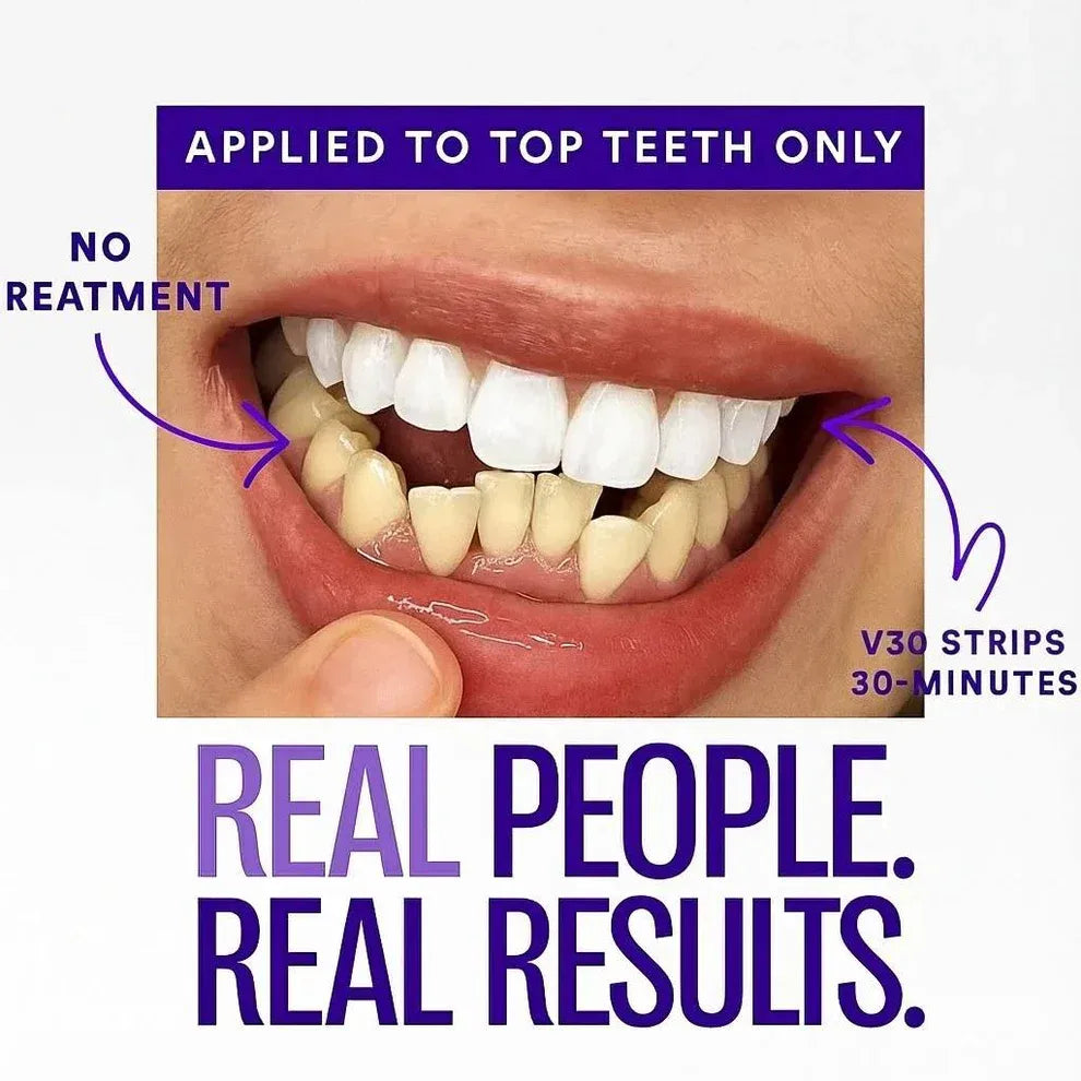 Stemhalo™🔥V34 Purple Whitening Strips, Instant Yellow Teeth Brightening